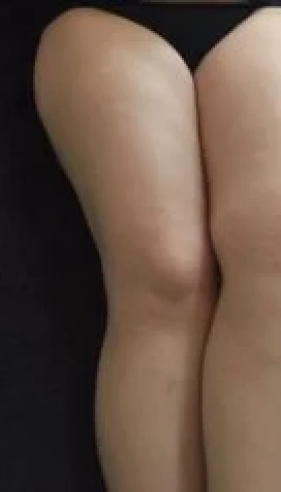 Female Escort