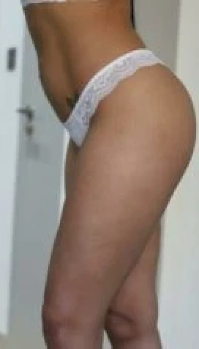 Female Escort